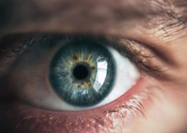 What is implantable Collamer lens (ICL) surgery?