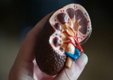 What is kidney removal (nephrectomy) surgery?