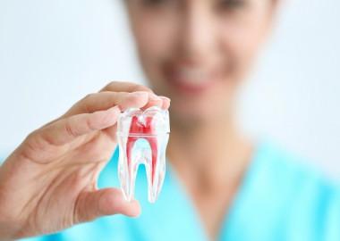 Prevention of root canal